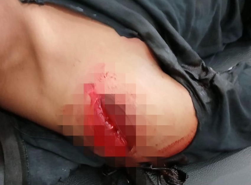 Ngeri! Stabat Rawan, Puluhan Geng Motor Bersajam Serang Warga, 4 Korban Luka Bacok