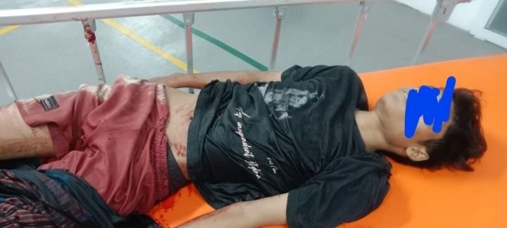 Aksi Tawuran di Pekan Labuhan Mencekam, 1 Korban Tewas Ditebas Celurit