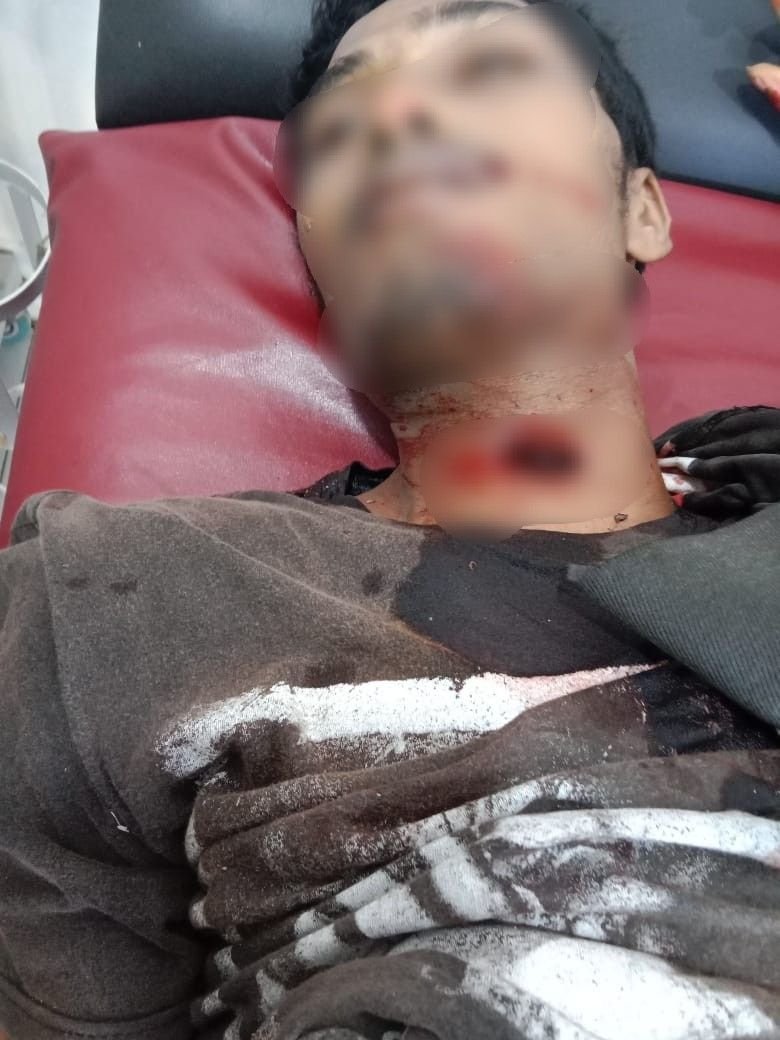 Belanda dan Temannya Warga Medang Deras Aniaya dan Tikam Seorang Nelayan Hingga Tewas