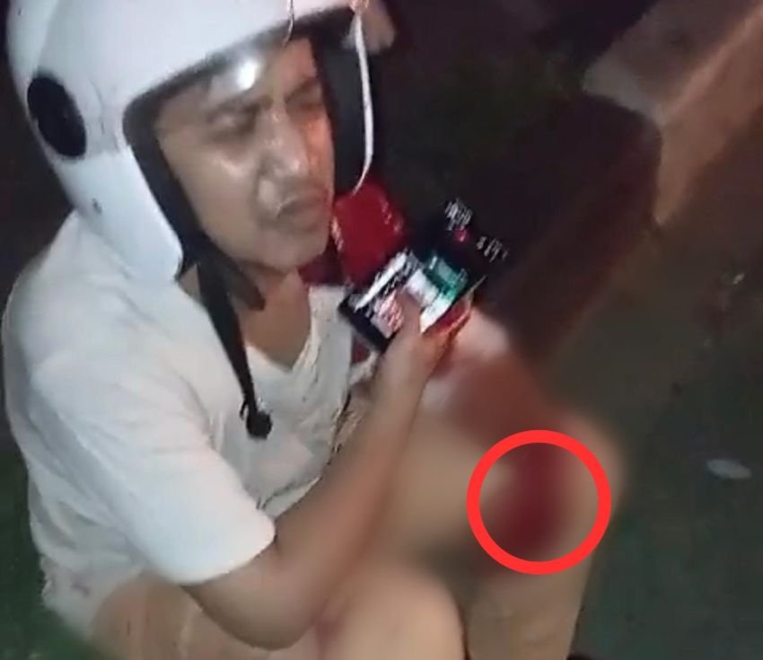 Pelaku Begal Sadis Bacok Tangan Korban Nyaris Putus Dikabarkan Ditangkap