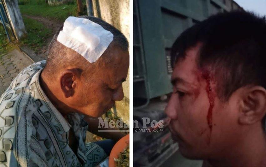 Soal Sopir Truk Keykey Diserang-Dianiaya, Korban Minta Polrestabes Tangkap Pelaku Lainnya