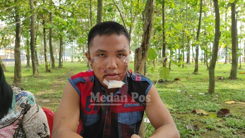 Casis Bintara Polri Dibegal, Motor Ditendang-Wajah Penuh Luka, Korban Berharap Masih Bisa Lanjut Tes