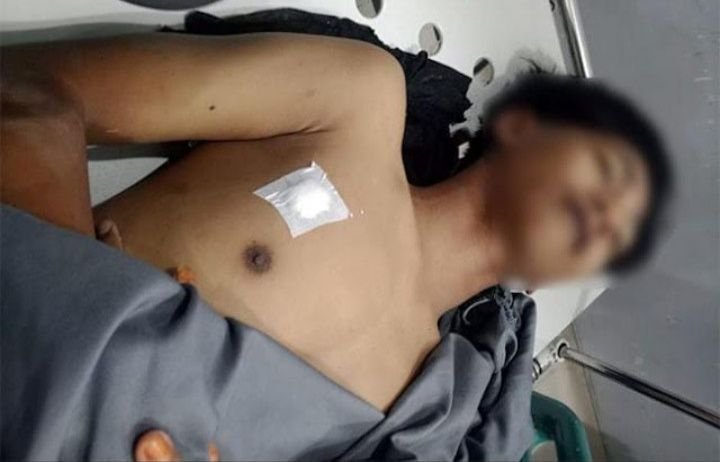 Tawuran Kembali Pecah di Belawan 1 Warga Tewas Dihantam Peluru Senapan Angin