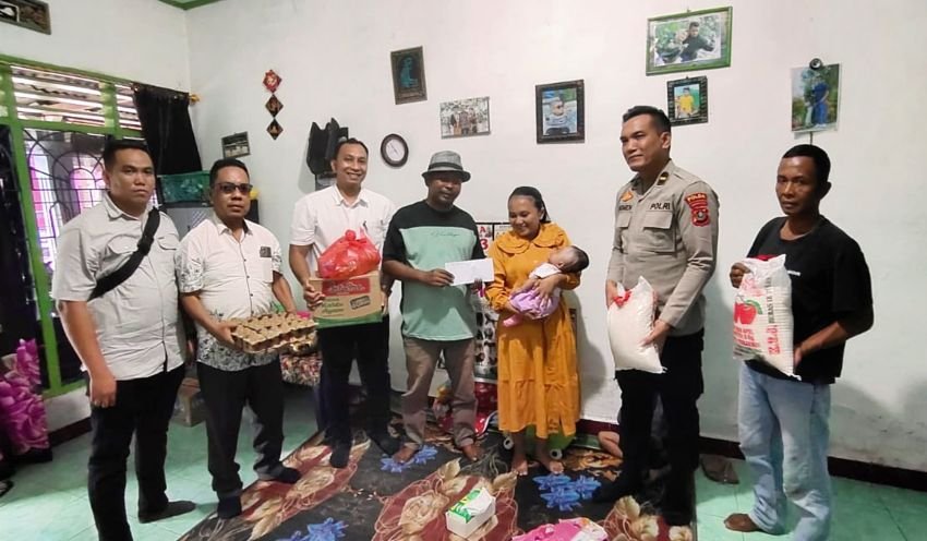 Uluran Tangan Pemkab dan Polres Sergai Untuk Balita Hidrosepalus