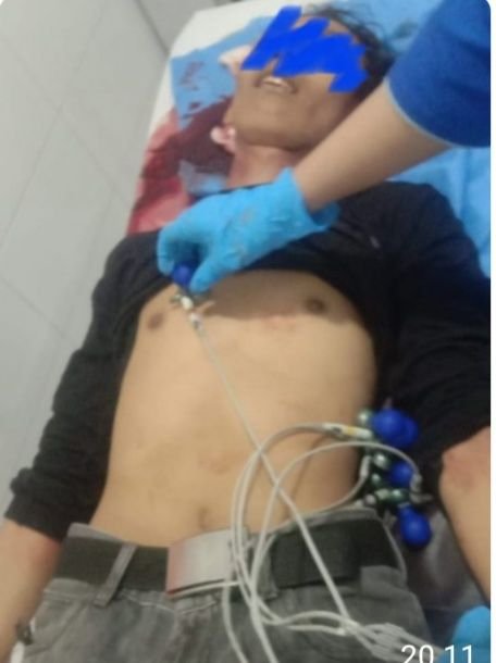 Tawuran Pecah di Tanjung Mulia, 1 Remaja Tewas Mengenaskan