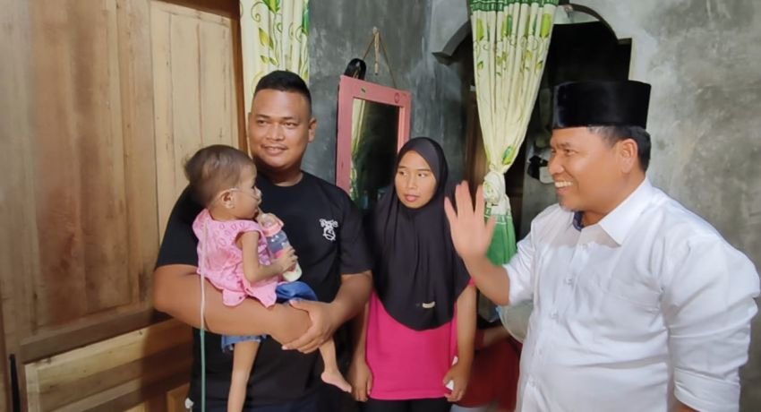 Anggota DPR Deli Serdang Kuzu SW Tarigan Bantu Penderita Jantung Bocor dan Kurang Gizi di Patumbak