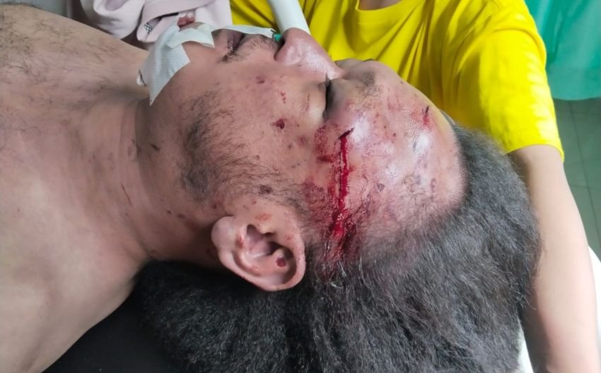 Wartawan di Medan Nico Saragih Ditemukan Meninggal di Kos dengan Sejumlah Luka, Polisi Selidiki Penyebabnya