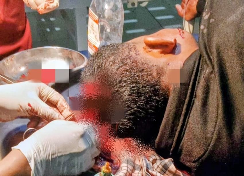 Cek Cok di Warung Tuak Berujung Pembacokan, Seorang Pelajar Kritis