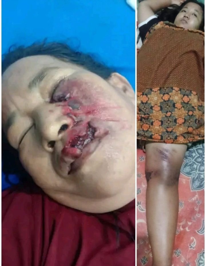 Wilkum Polsek Medan Labuhan Rawan Begal, Pedagang Pajak Pasar V Marelan Dibegal di Simpang Dobi