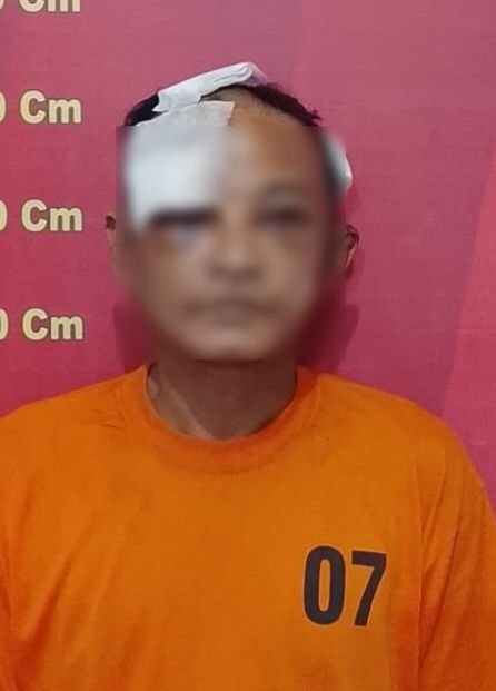 Pencuri Diamuk Massa, Dalam Kondisi Wajah Luka-luka Pelaku Diserahkan ke Polsek Medan Area