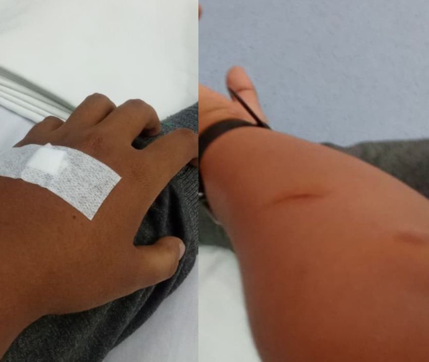 Mahasiswa USU Korban Tabrak Lari : Sempat Tidak Sadarkan Diri, Tubuh Lecet-lecet