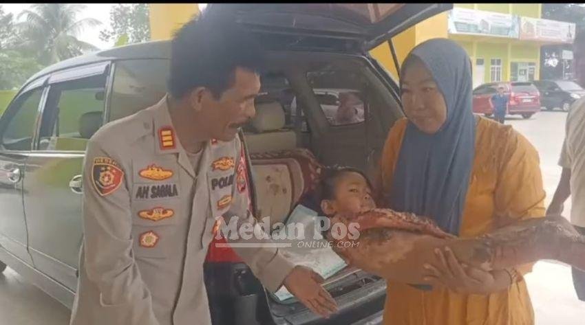 Respons Cepat Polisi, Kayla Bocah Luka Bakar Jalani Perawatan di RS Bidadari