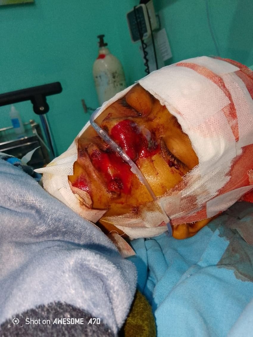 Ngeriii.. 2 Tahun Laporan Pembacokan Nyaris Tewas Ngendap di Polresta Deli Serdang, Kapolresta Dan Kasat Reskrim Kompak Bungkam..!!