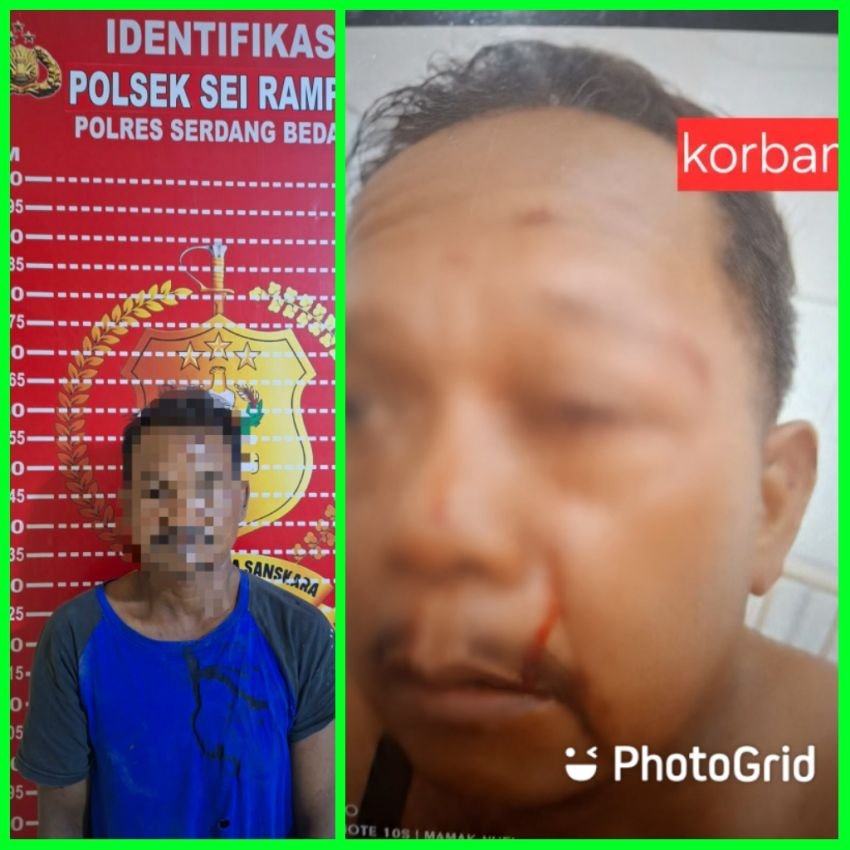 Cekcok Gegara Macet, Suprayogi Dilempar Batu Hingga Alami Kebutaan