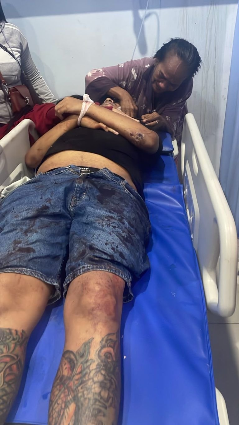 Polda Sumut Ungkap Kasus Penembakan Wadan Koti PP Deli Serdang
